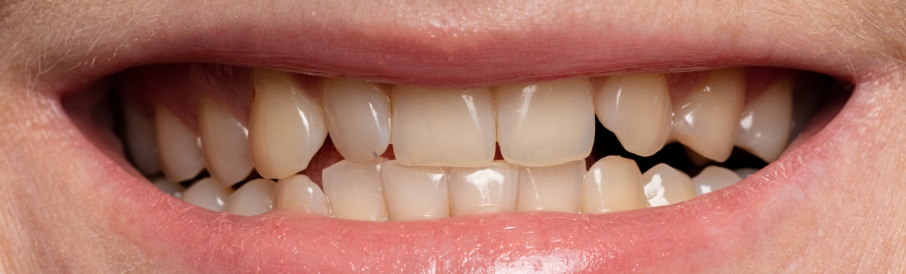 New-Project-81.jpg New-Project-81.jpg